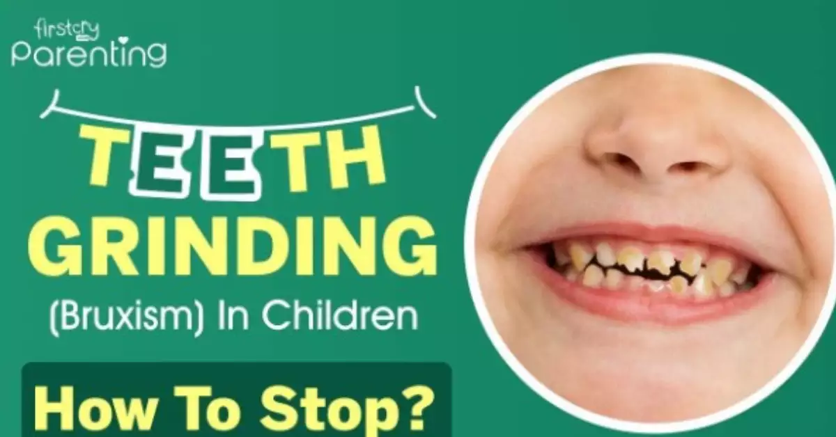 What is Bruxism Teeth Grinding – Basic Guide for Parents